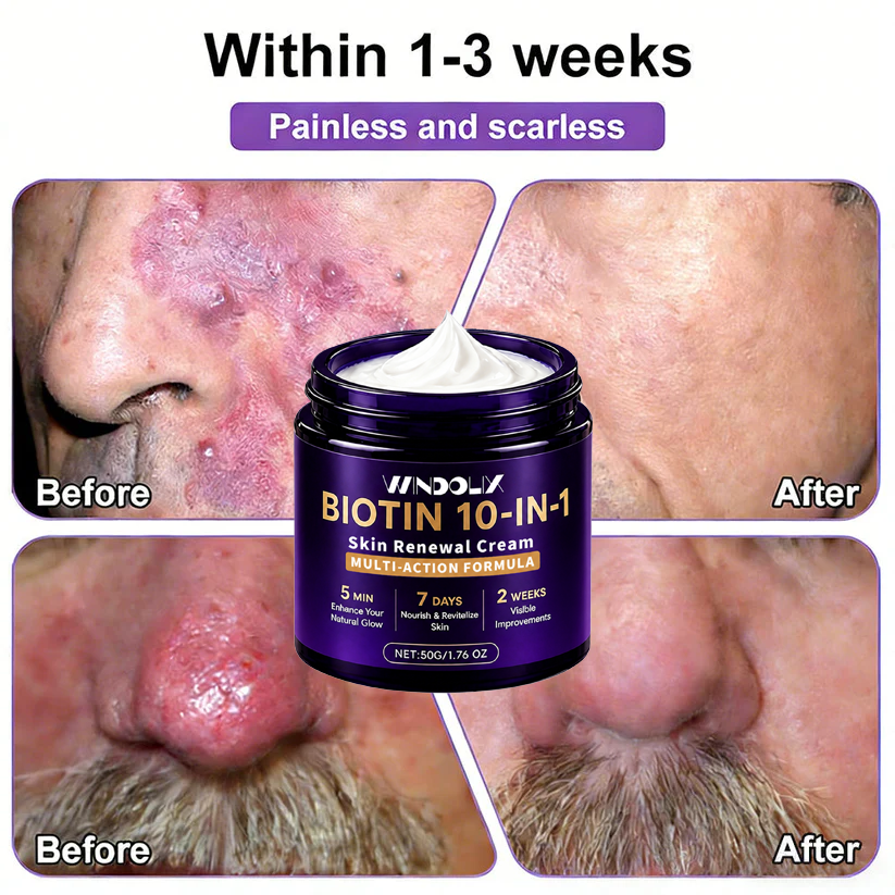 🔥LAST DAY 50% OFF - Windolix® Biotin 10-in-1 Skin Restoration Cream