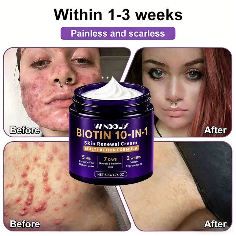 🔥LAST DAY 50% OFF - Windolix® Biotin 10-in-1 Skin Restoration Cream