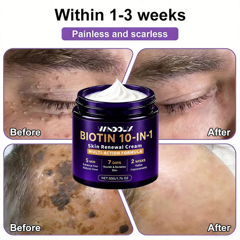 🔥LAST DAY 50% OFF - Windolix® Biotin 10-in-1 Skin Restoration Cream