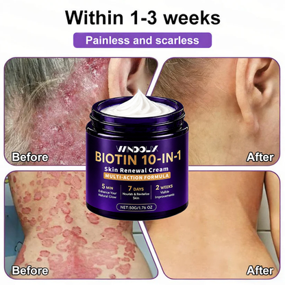 🔥LAST DAY 50% OFF - Windolix® Biotin 10-in-1 Skin Restoration Cream