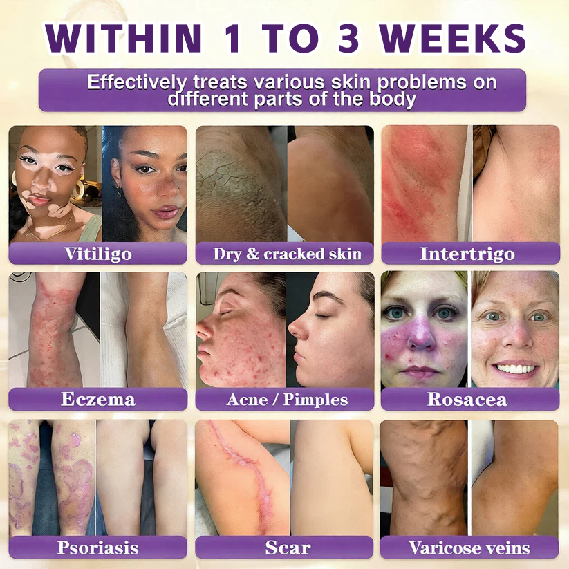 🔥LAST DAY 50% OFF - Windolix® Biotin 10-in-1 Skin Restoration Cream