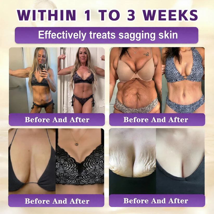 🔥LAST DAY 50% OFF - Windolix® Biotin 10-in-1 Skin Restoration Cream