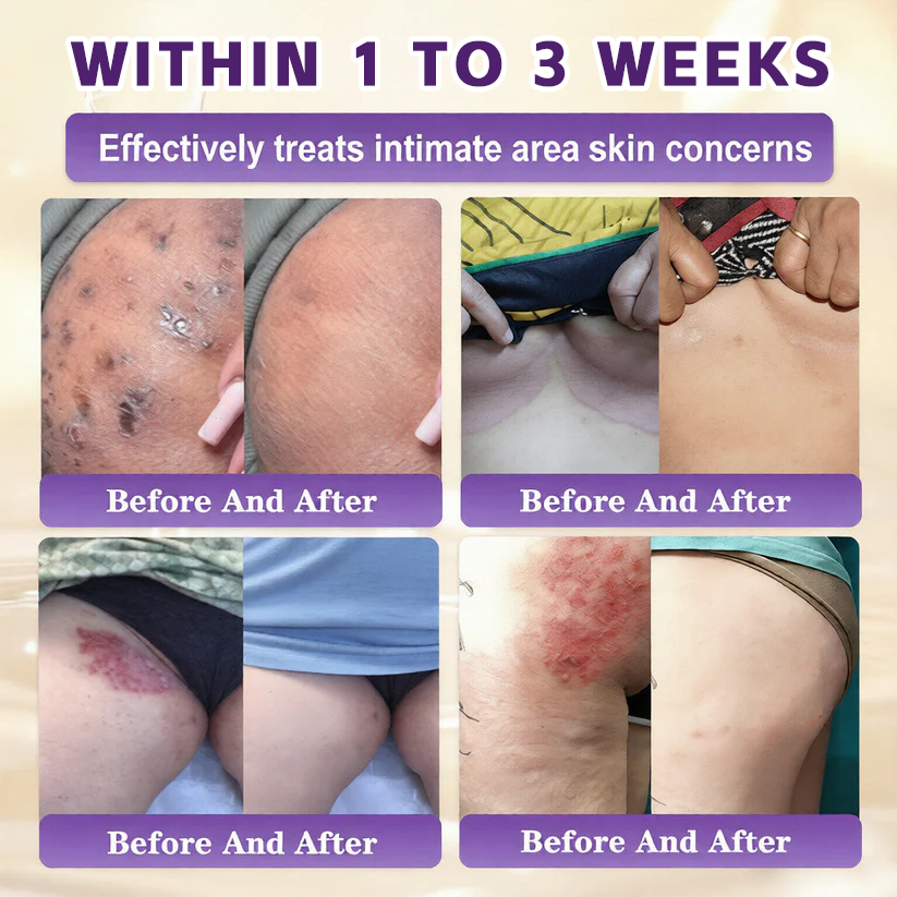 🔥LAST DAY 50% OFF - Windolix® Biotin 10-in-1 Skin Restoration Cream
