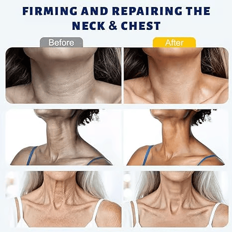 ✨ Windolix™ Instant Neck Lift Cream  — 🧴 Infused with Retinol & Hyaluronic Acid | Firms the Neck, Reduces Wrinkles & Double Chin